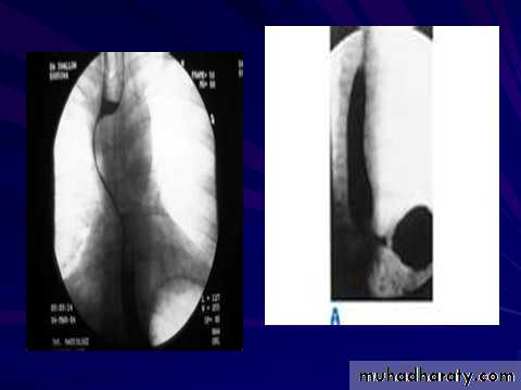 Radiology of G.I.T