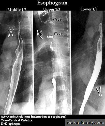 Radiology of G.I.T