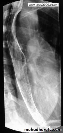 Radiology of G.I.T