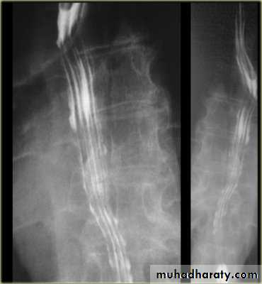 Radiology of G.I.T