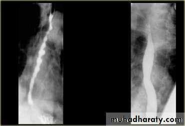 Radiology of G.I.T
