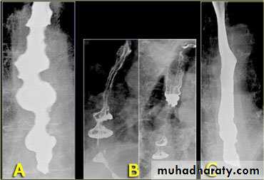 Radiology of G.I.T