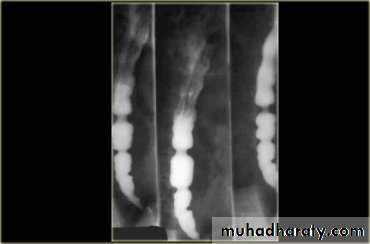 Radiology of G.I.T