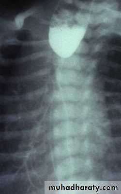 Radiology of G.I.T