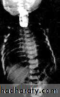 Radiology of G.I.T