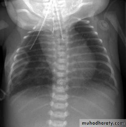 Radiology of G.I.T