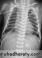 Radiology of G.I.T