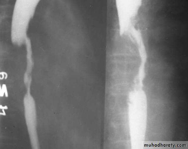 Radiology of G.I.T