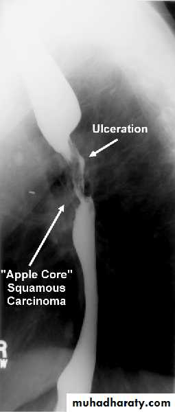Radiology of G.I.T