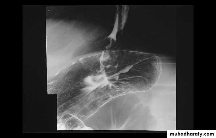 Radiology of G.I.T
