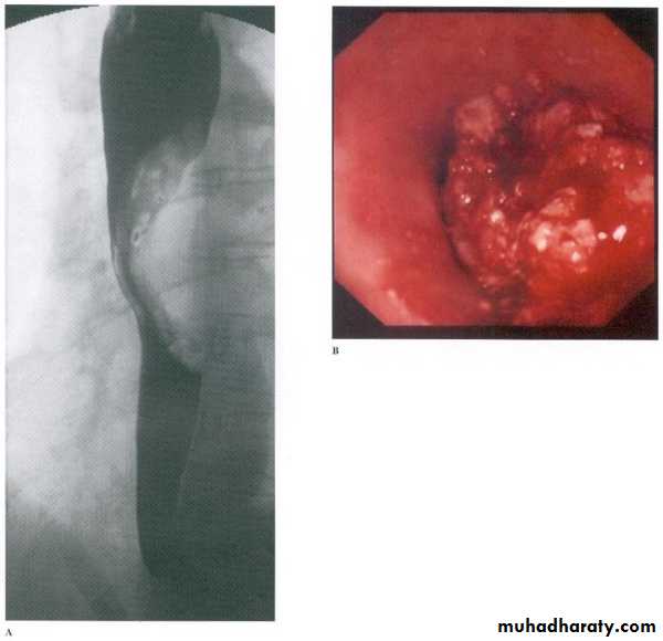 Radiology of G.I.T