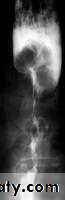 Radiology of G.I.T
