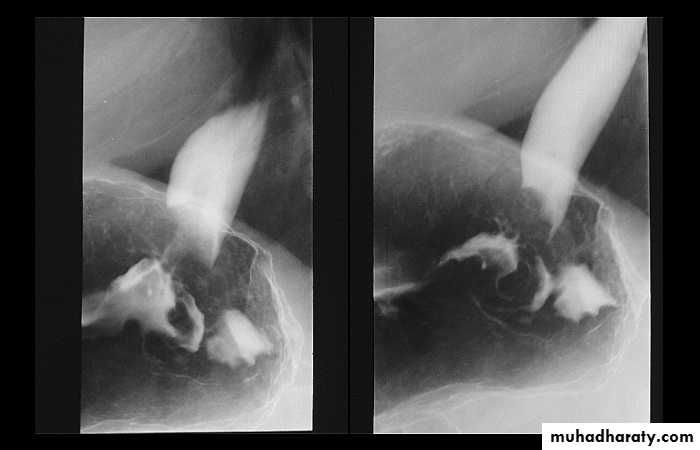 Radiology of G.I.T