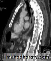 Radiology of G.I.T