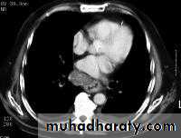 Radiology of G.I.T