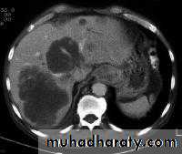 Radiology of G.I.T
