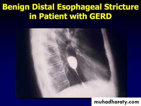 Radiology of G.I.T