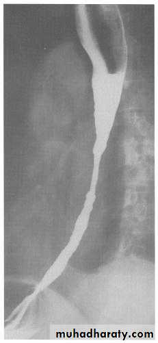 Radiology of G.I.T