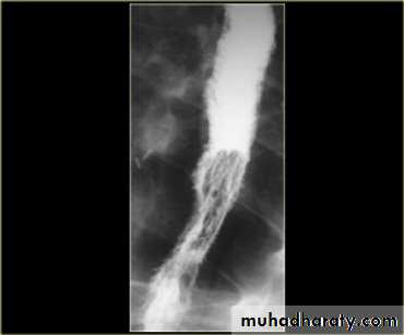 Radiology of G.I.T