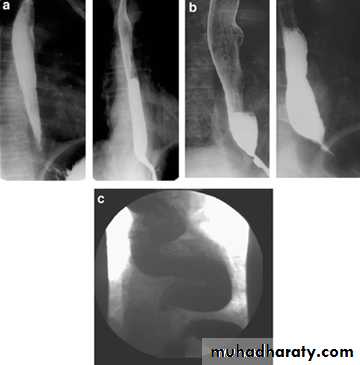 Radiology of G.I.T