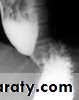 Radiology of G.I.T