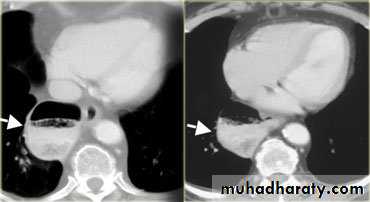 Radiology of G.I.T