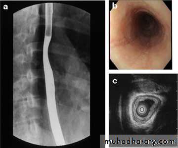 Radiology of G.I.T