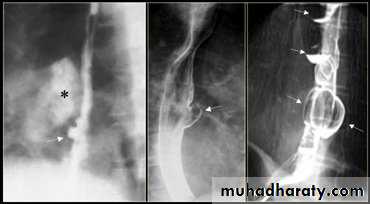 Radiology of G.I.T