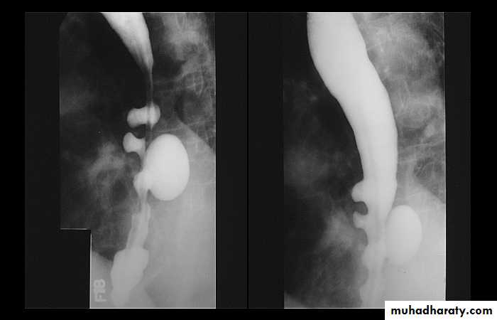 Radiology of G.I.T