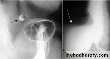 Radiology of G.I.T