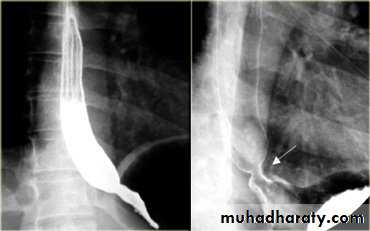 Radiology of G.I.T