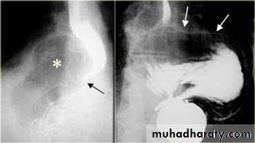 Radiology of G.I.T