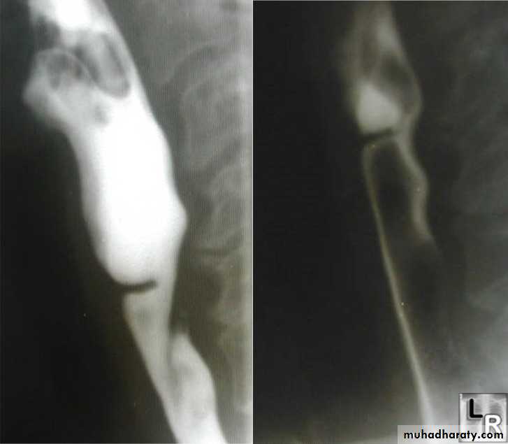 Radiology of G.I.T