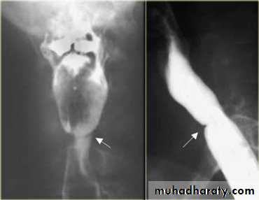 Radiology of G.I.T