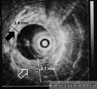 Radiology of G.I.T