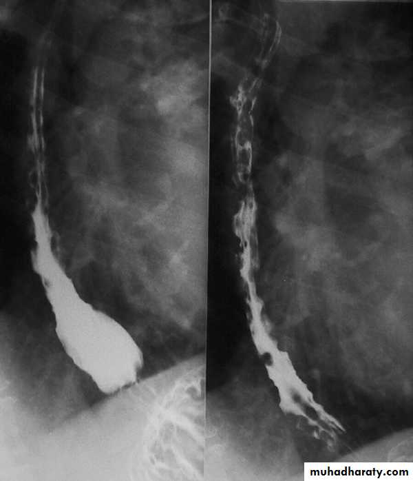Radiology of G.I.T