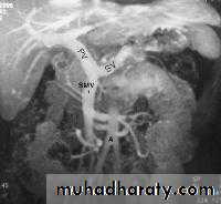 Radiology of G.I.T