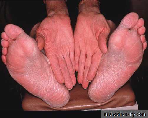 FUNGAL INFECTION 2
