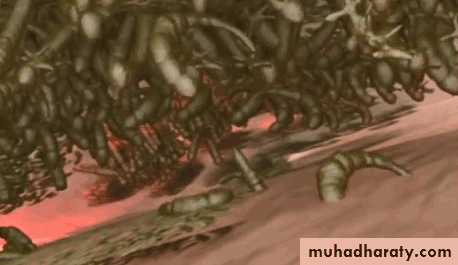 FUNGAL INFECTION 2