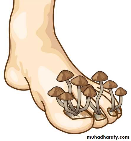 FUNGAL INFECTION 2