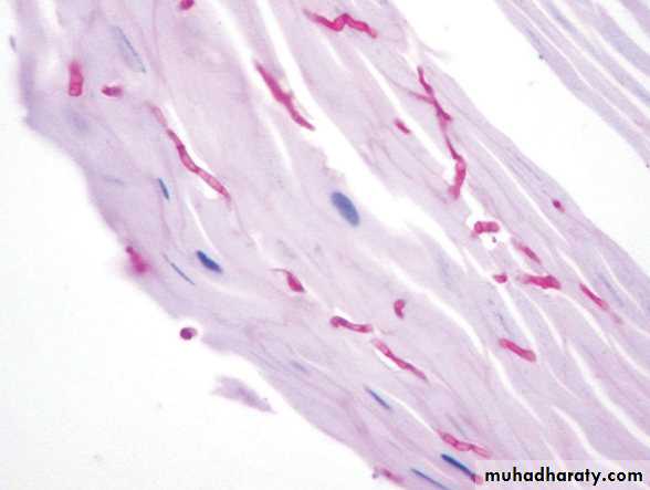 FUNGAL INFECTION 2