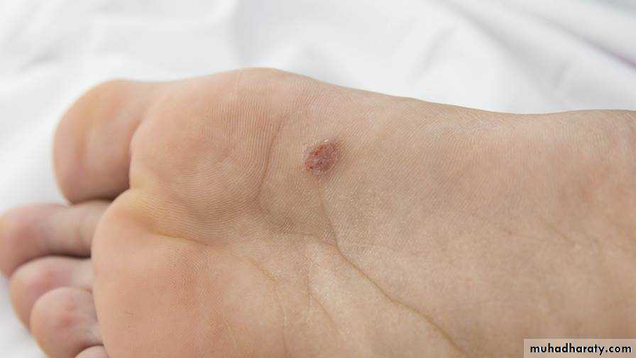Viral infection 1
