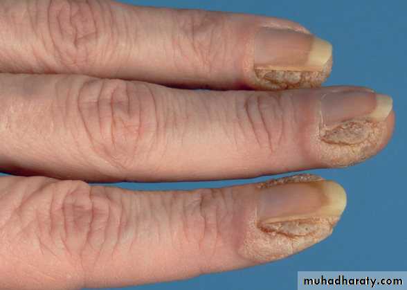 Viral infection 1
