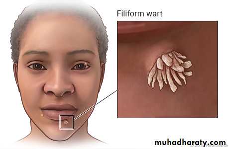 Viral infection 1