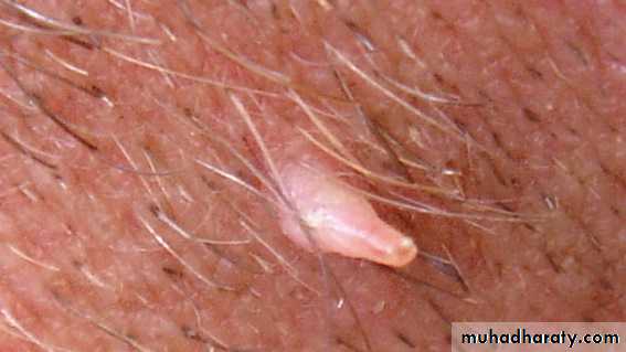 Viral infection 1