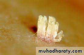 Viral infection 1