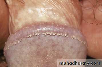 Viral infection 1