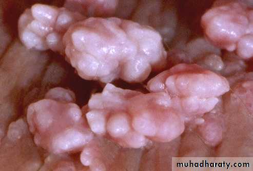 Viral infection 1