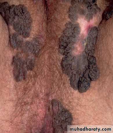 Viral infection 1