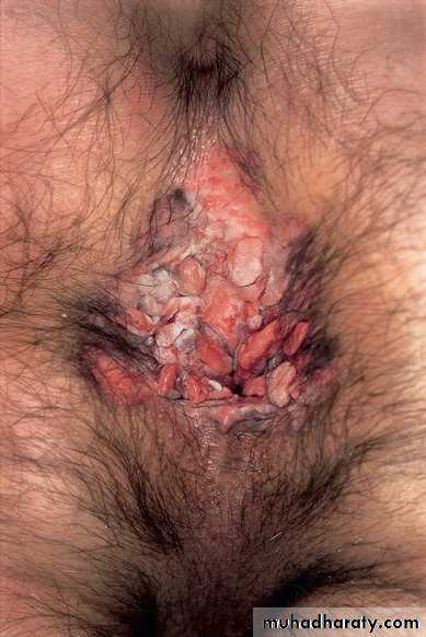 Viral infection 1